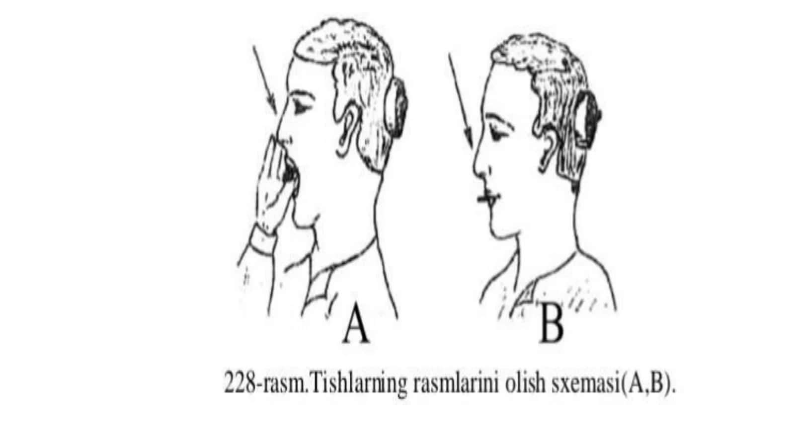 Tishlarning rentgen anatomiyasi 3