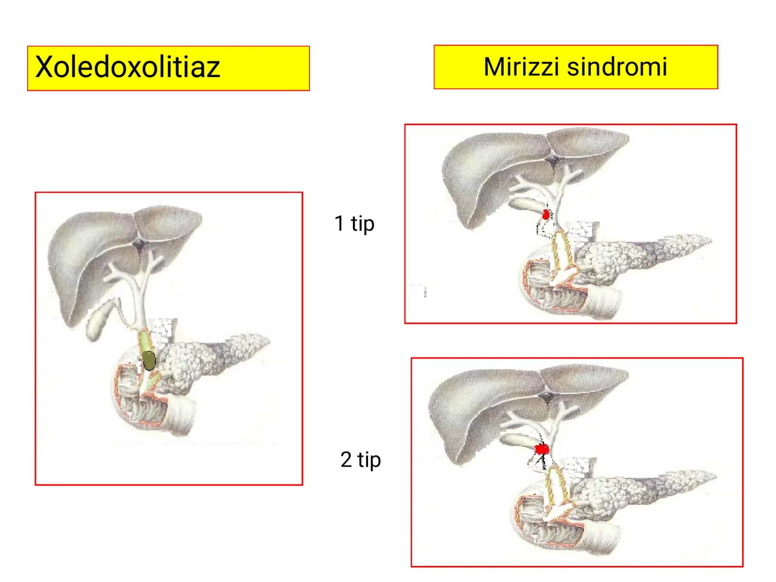 Mexanik sariqlikning etiologiyasi 3