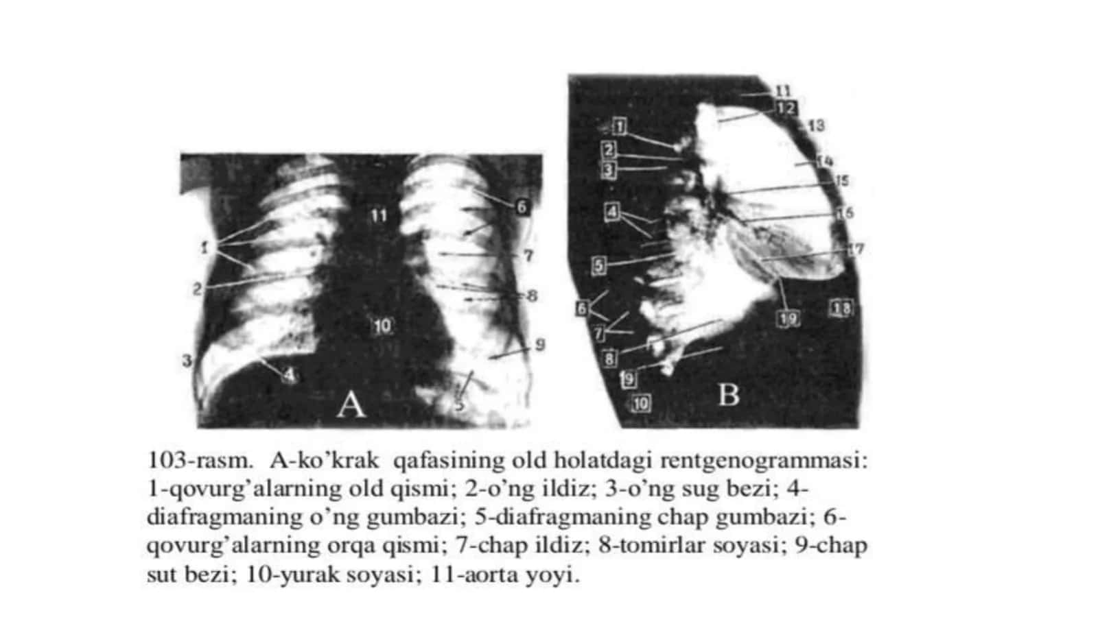 Nafas a’zolarining rentgenanatomiyasi 3