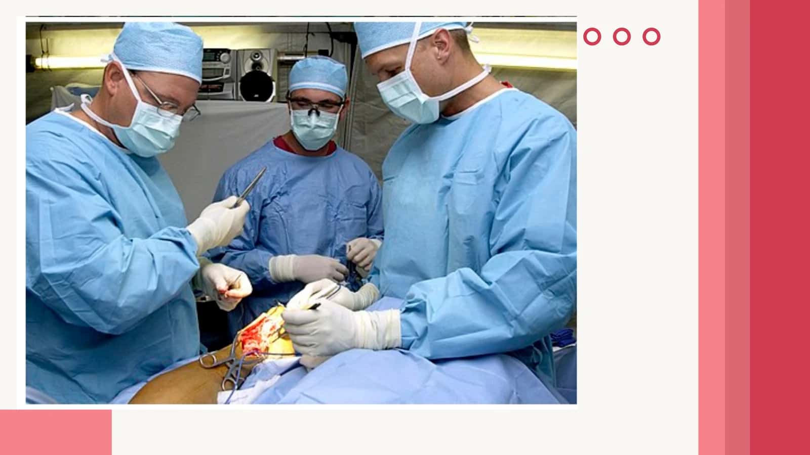 Operatsiya Turlari klinik anatomiya 3