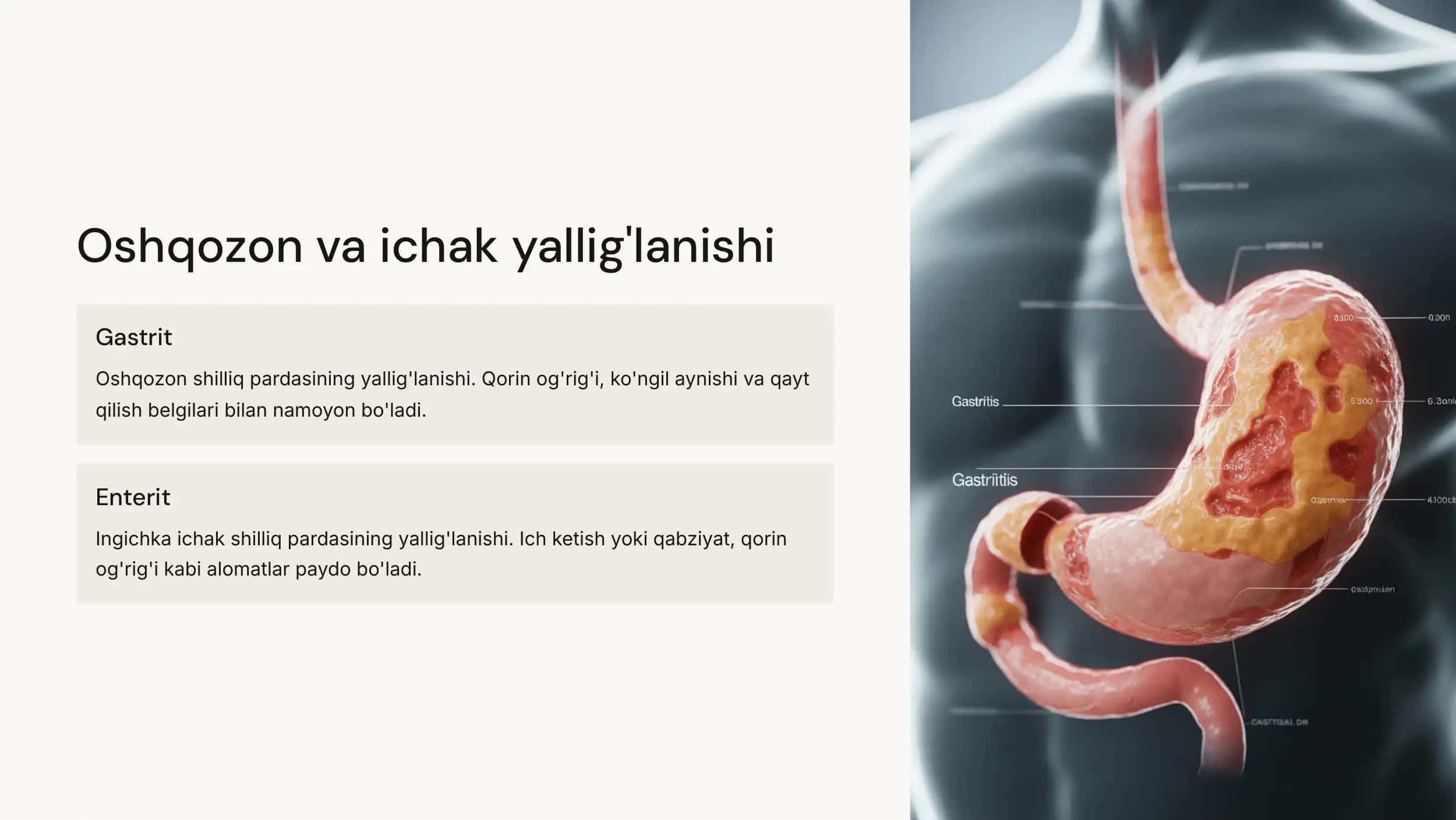 Oshqozon-ichak kasalliklari va ularning oldini olish 3