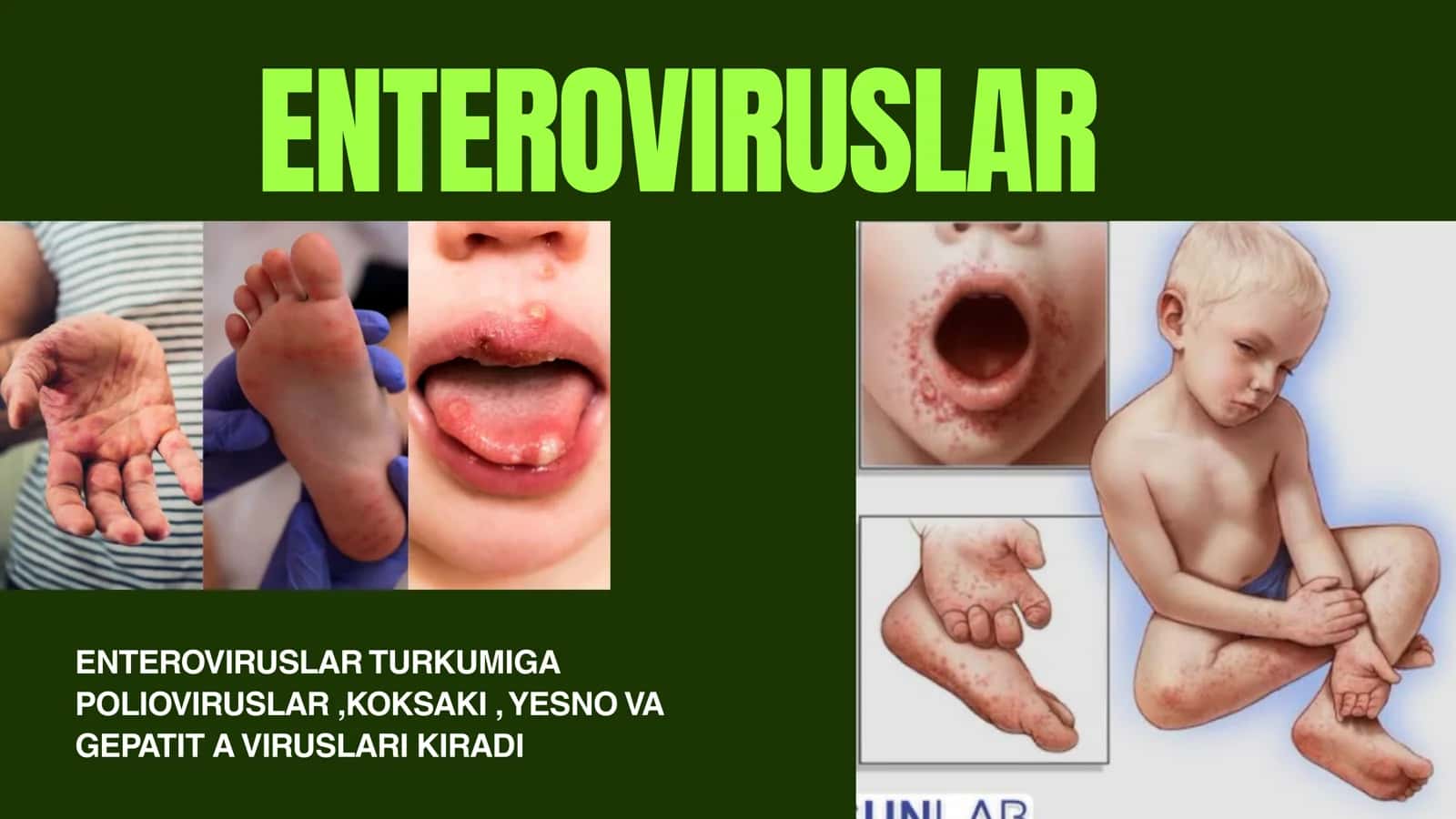 RNK SAQLOVCHI VIRUSLAR KELTIRIB CHIQARUVCHI YUQUMLI KASALLIK QOʻZGʻATUVCHILARI: PIKORNOVIRUS ( POLIMIYELIT GEPATIT A ) KORONOVIRUSLAR. XARAKTERISTIKASI VA LABARATORIYA TASHXISI 3