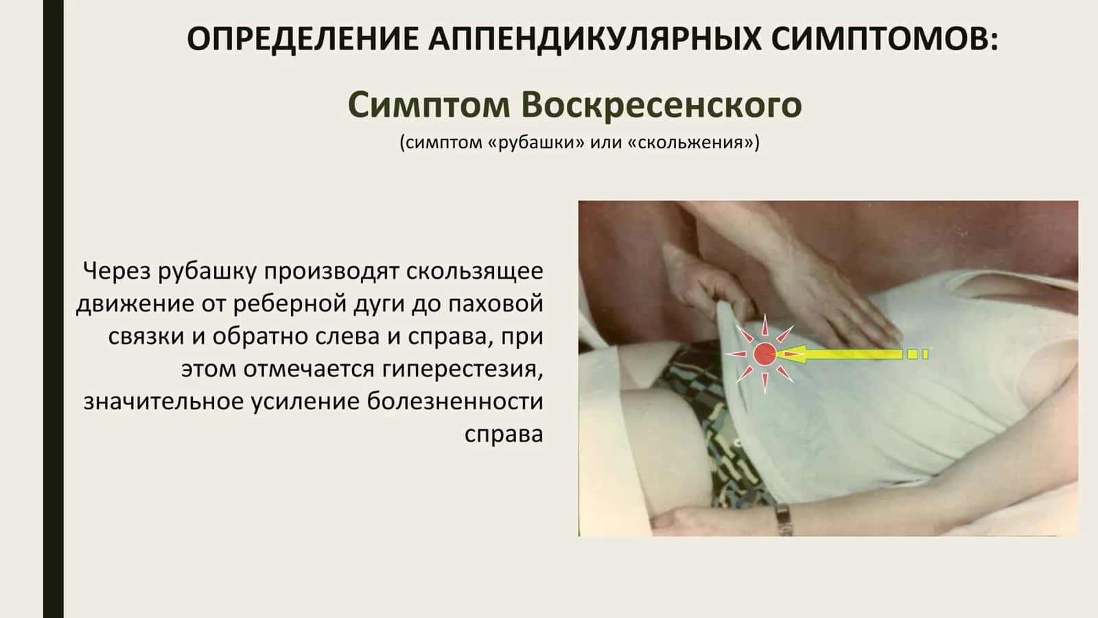 Ректальное исследование при тазовом аппендиците 3