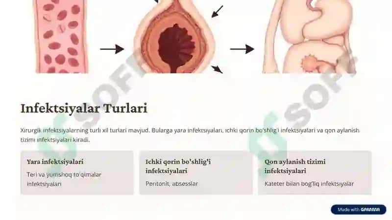 Umumiy Xirurgik Infektsiyalar 3