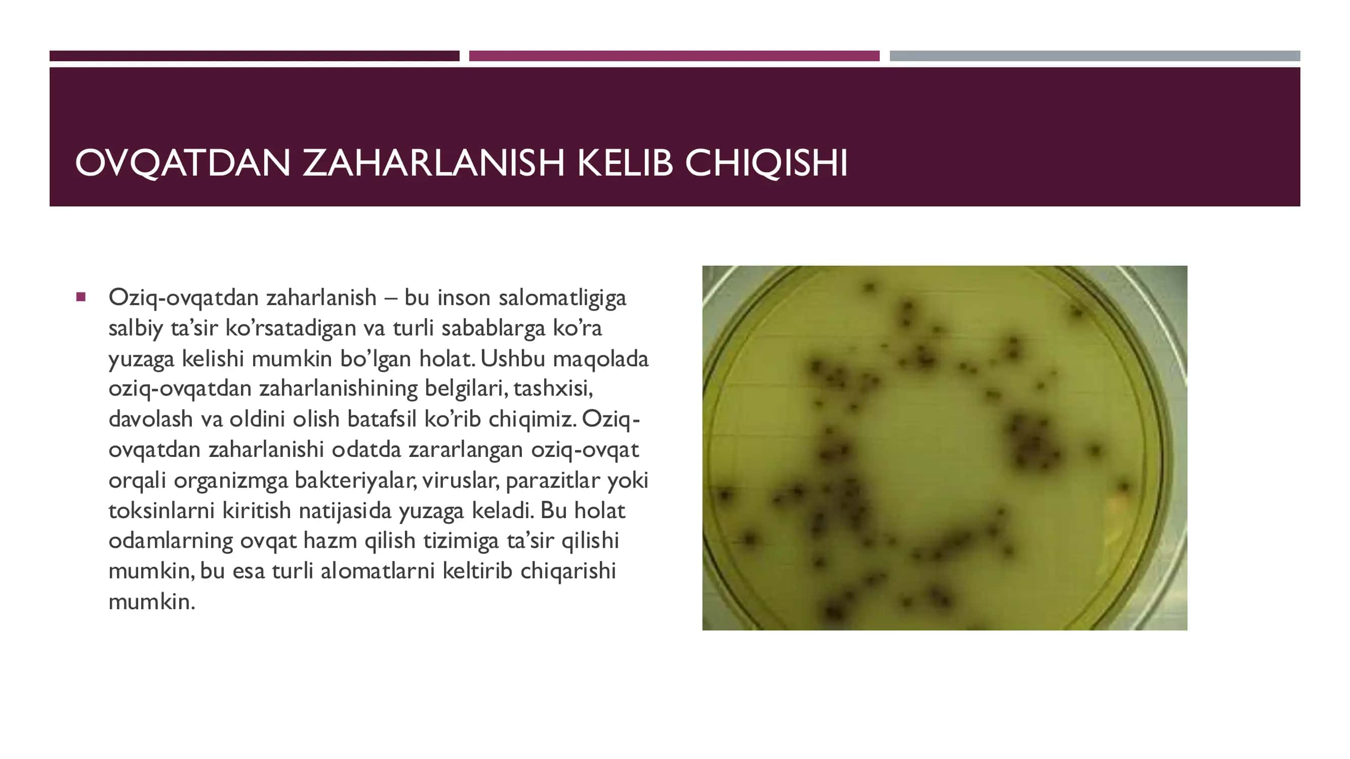 OVQATDAN ZAHARLANISH VA ULARNI OLDINI OLISH 3