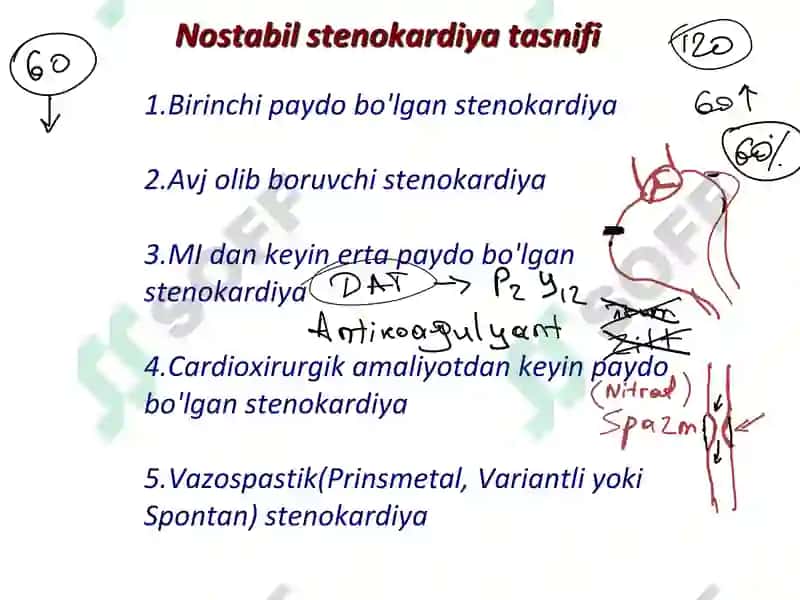 Yurak ishemik kasalliklari 5
