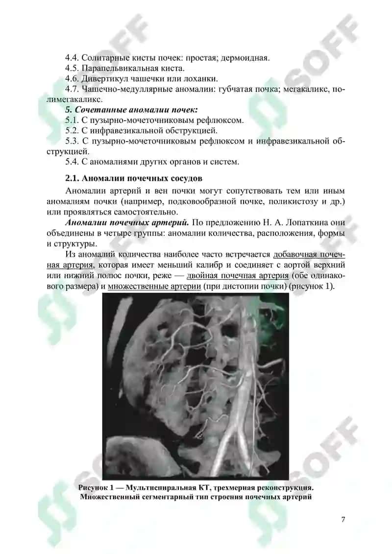 Аномалии мочеполовых органов 7