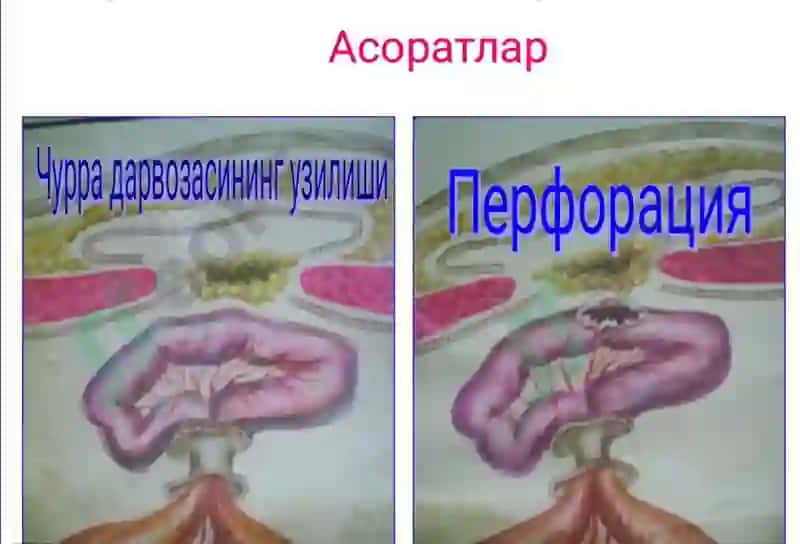 Xirurgiya churralar 8