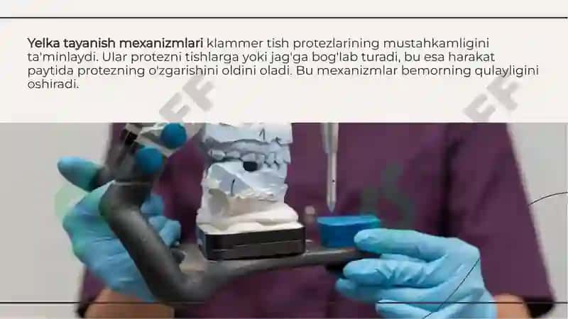 Klammer Tish Protezlari 8