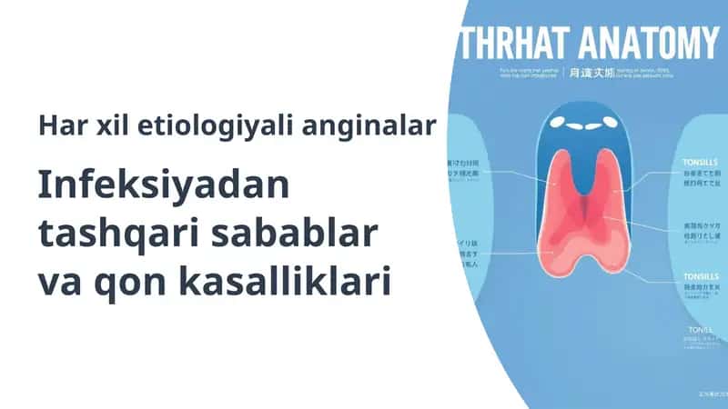 Anginalar 1