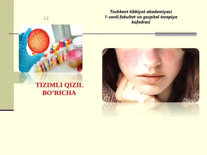 Tizimli Qizil Bo’richa 1
