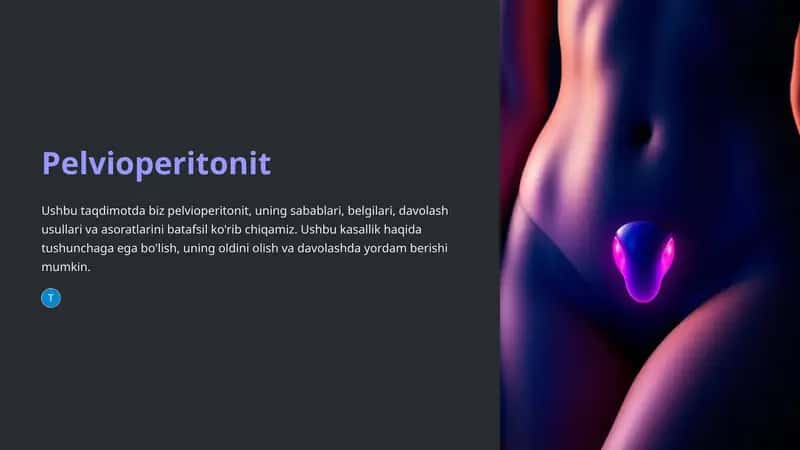 Pelvioperitonit 1