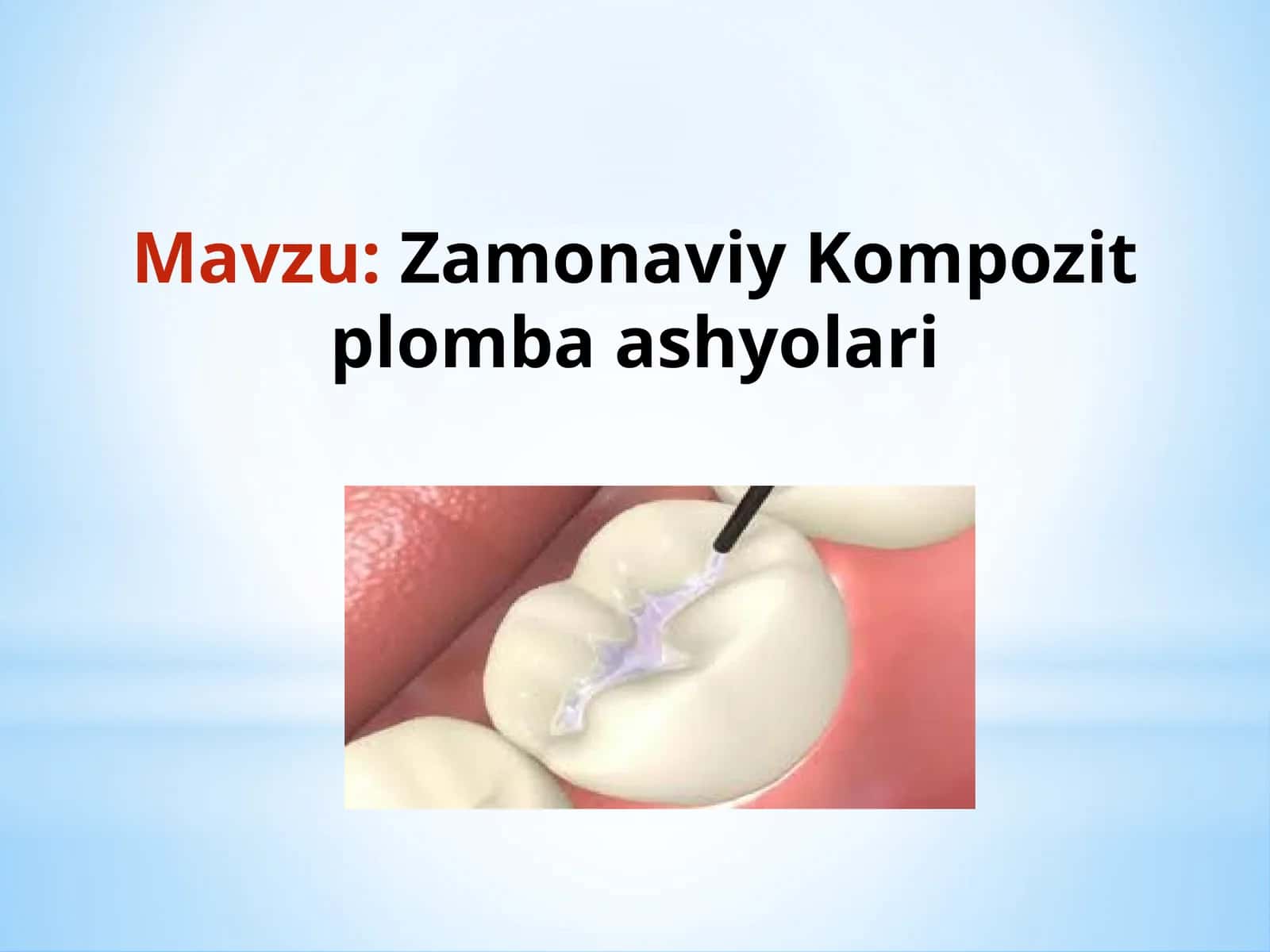 Zamonaviy Kompozit plomba ashyolari 1