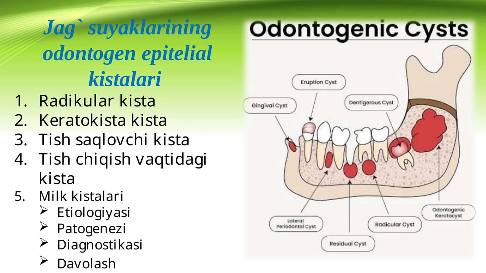 Jag` suyaklarining odontogen epitelial kistalari 1