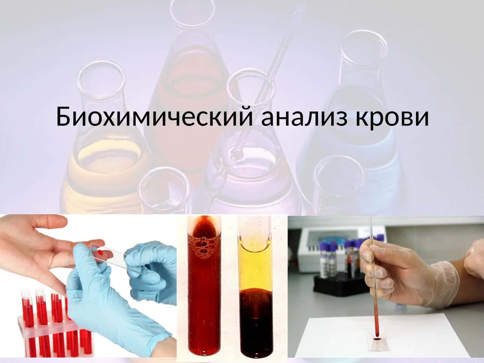 Биохимический анализ крови 1