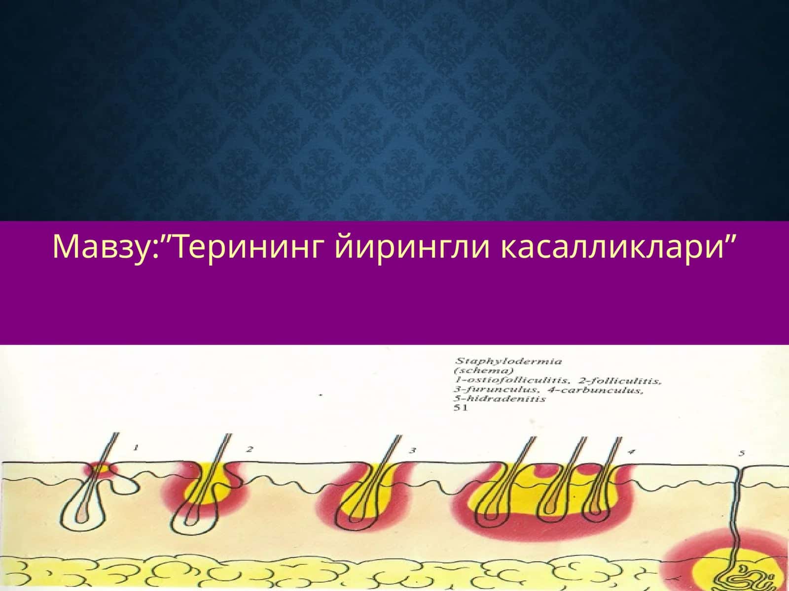 Терининг йирингли касалликлари 1