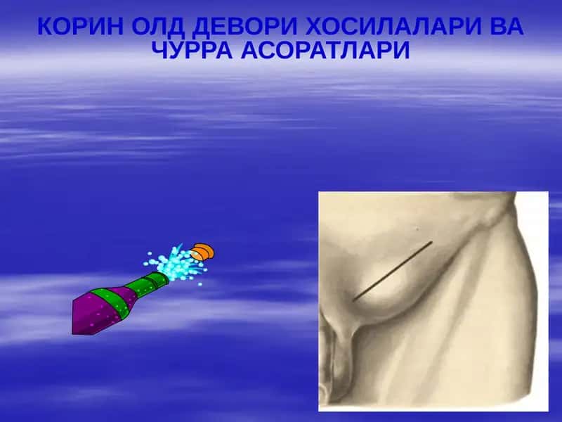 КОРИН ОЛД ДЕВОРИ ХОСИЛАЛАРИ ВА ЧУРРА АСОРАТЛАРИ 1