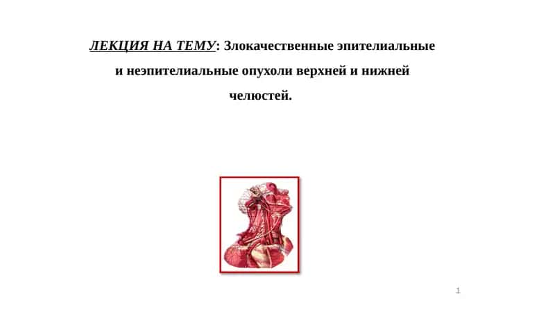 Злокачественные эпителиальные инеэпителиальныеопухоли верхней и нижней челюстей 1