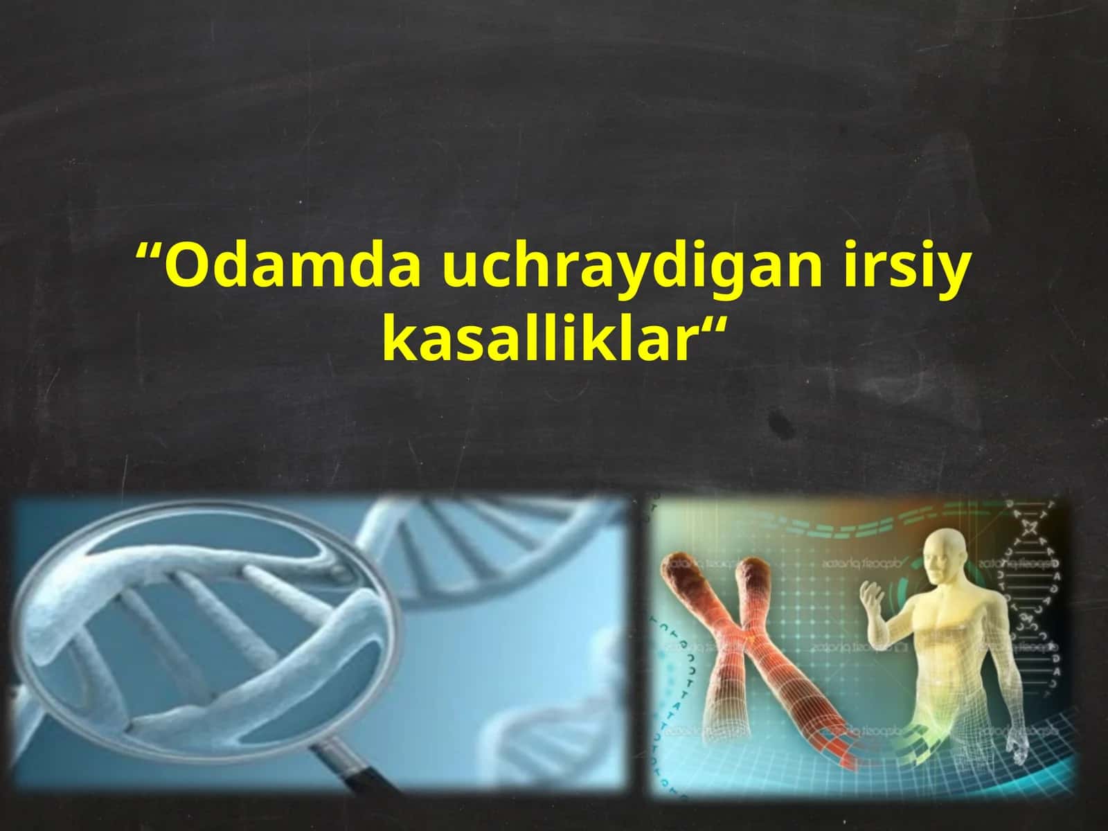 Odamda uchraydigan irsiy kasalliklar 1