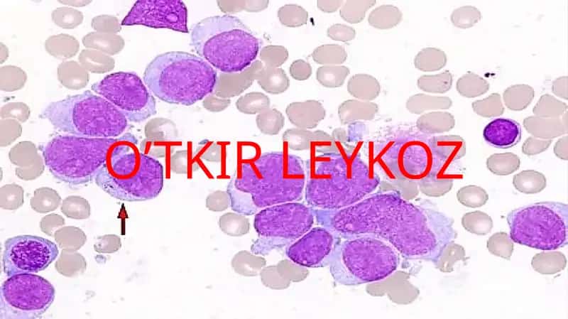 O’TKIR LEYKOZ 1