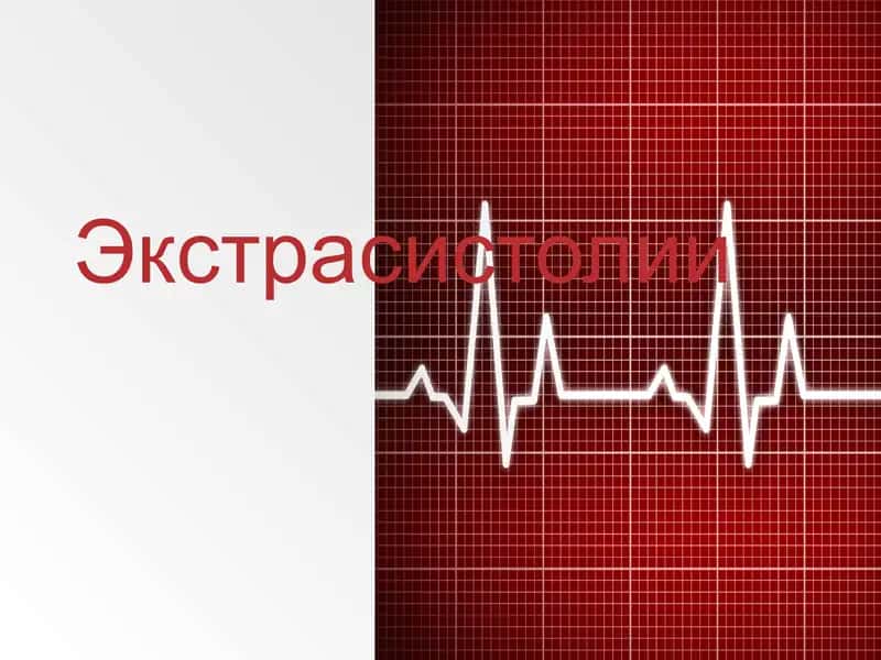 Экстрасистолии 1