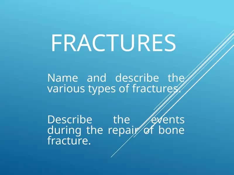 Bone Fractures 1