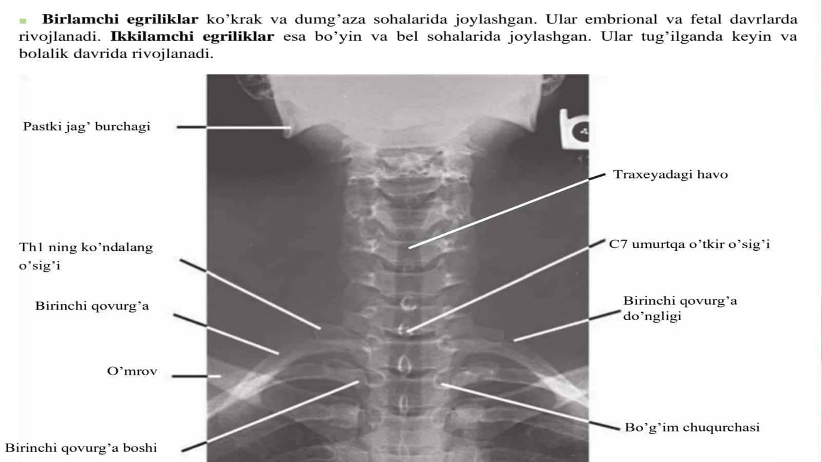 Umurtqapog'onasiningabnormalegriliklari 1