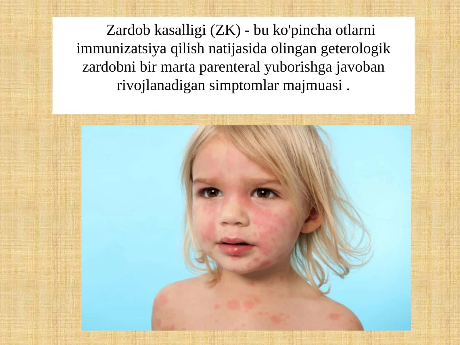 Zardobkasalligi (ZK) 1