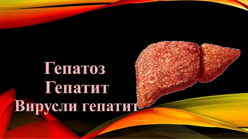 ГепатозГепатитВирусли гепатит 1
