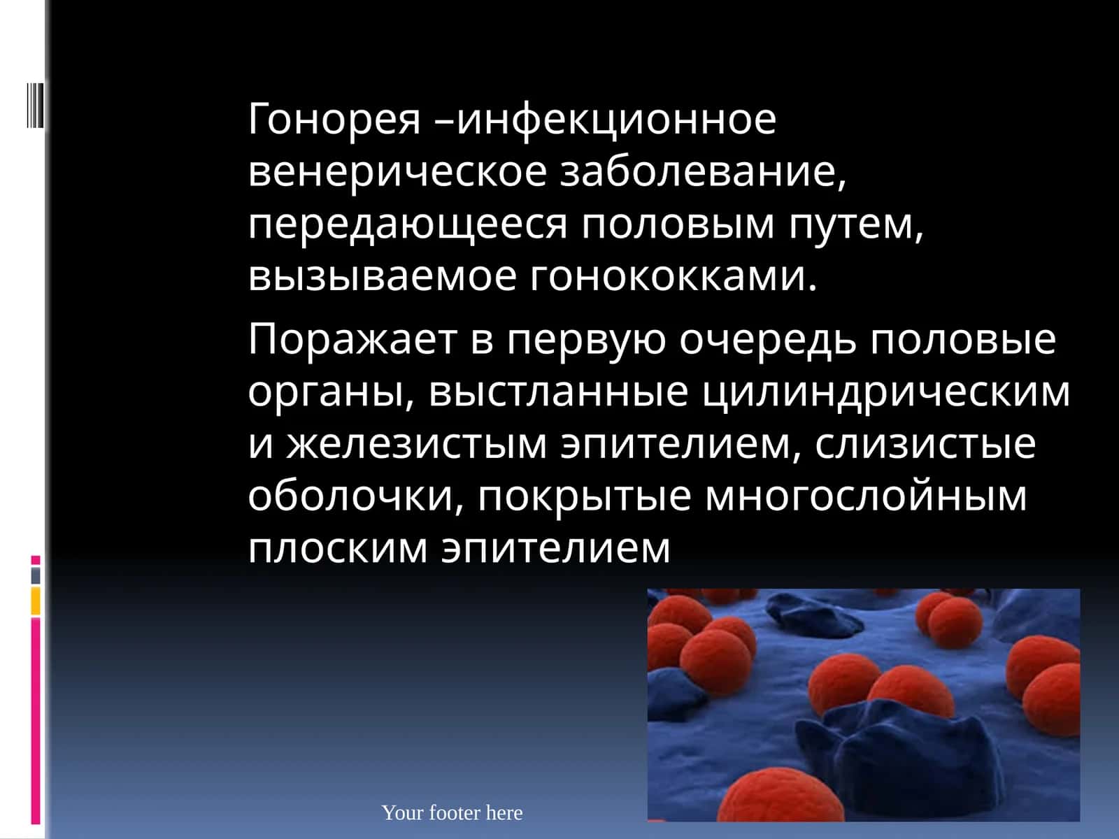 Гонорея 1