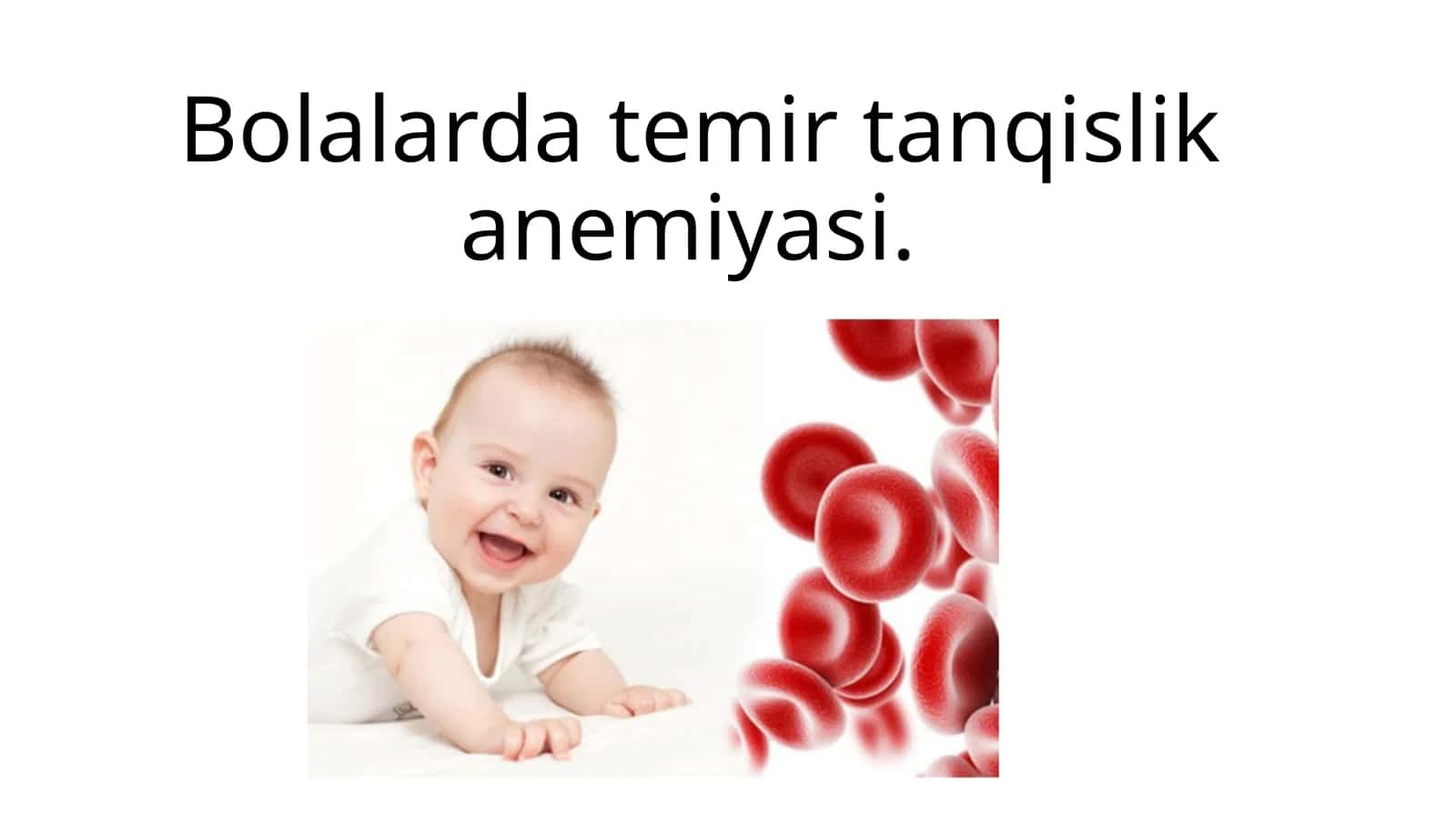 bolalarda temir tanqislik anemiyasi 1