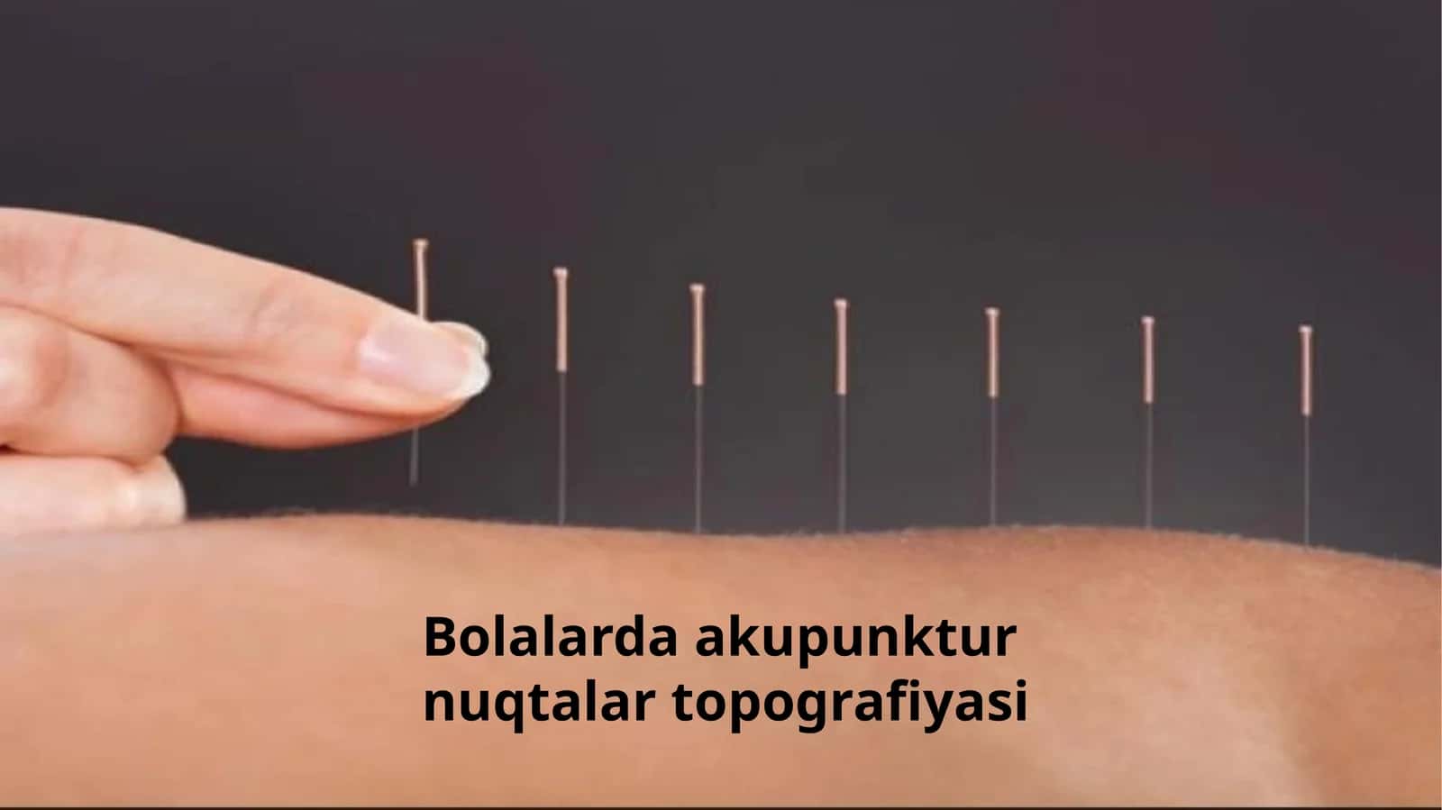 Bolalarda acupuncture nuqtalar topografiyasi 1