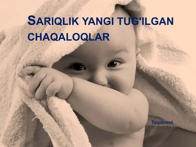 Sariqlik yangi tug'ilgan chaqaloqlar 1