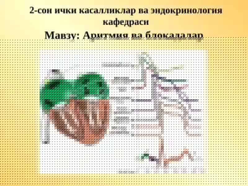 Аритмия ва блокадалар