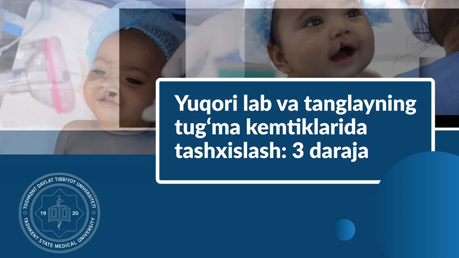 Yuqori labva tanglayning tug‘ma kemtiklarida tashxislash 1