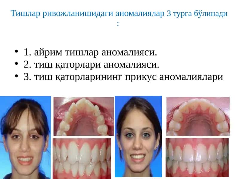 Тишлардаги аномалиялар 1