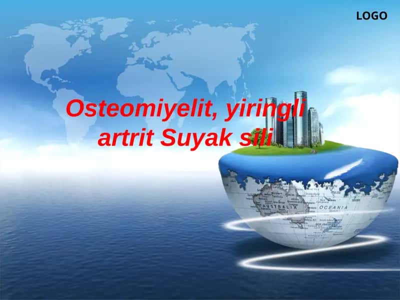Osteomiyelit 1
