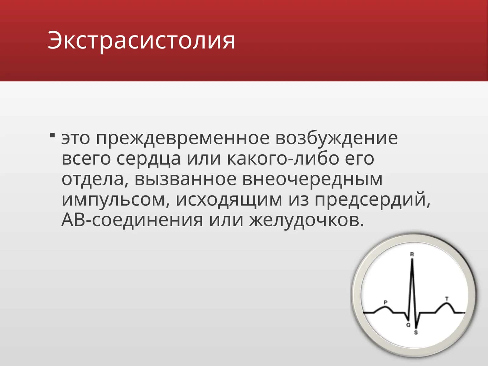 Экстрасистолия 1