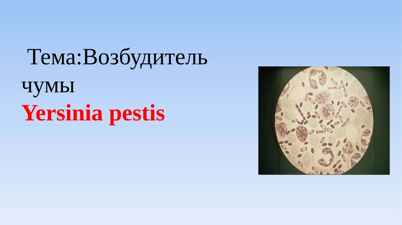 Тема:Возбудитель чумы 1