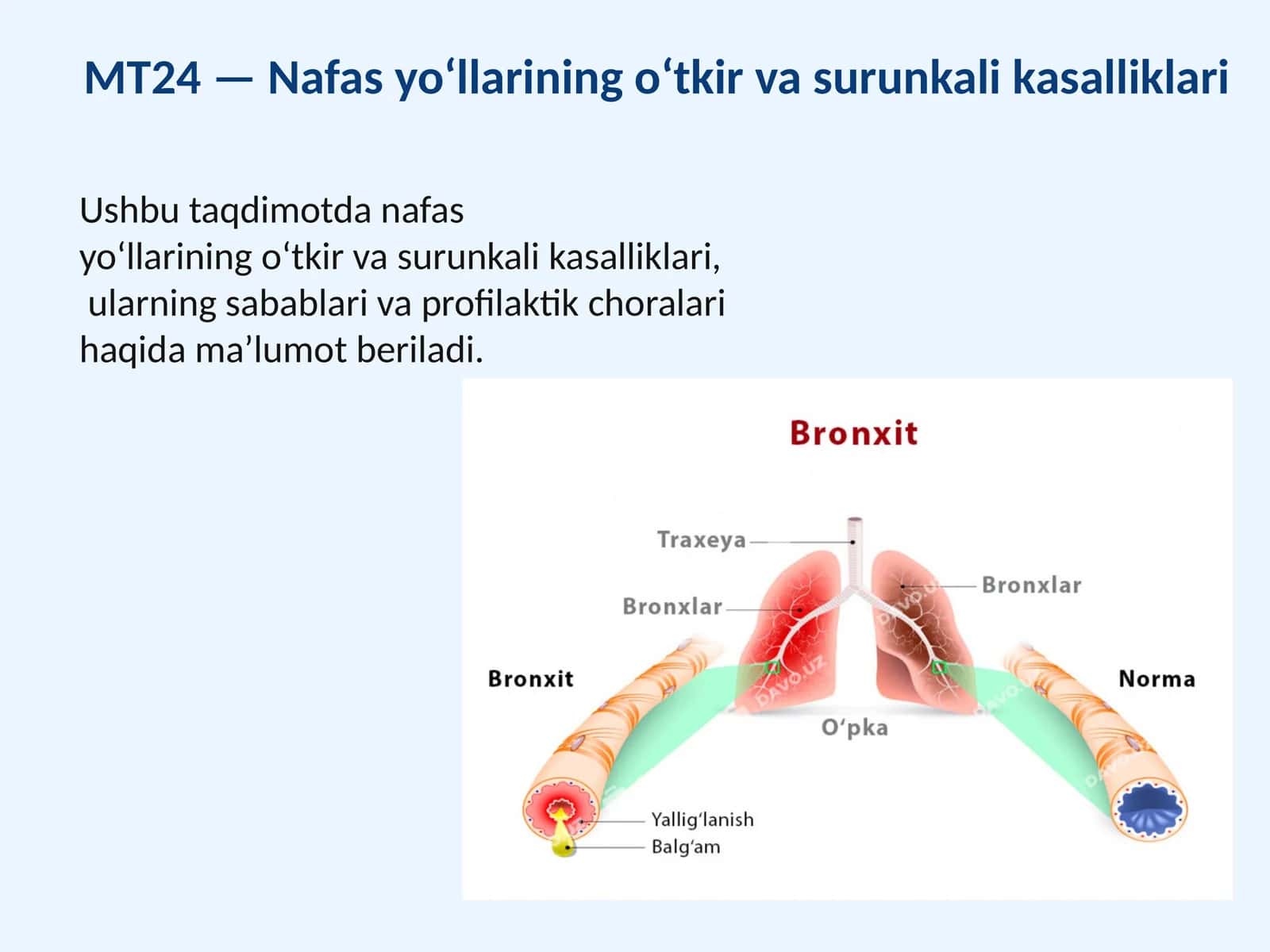 MT24 —Nafasyo‘llariningo‘tkirvasurunkalikasalliklari 1
