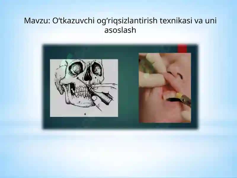 Oʻtkazuvchi ogʻriqsizlantirish texnikasi va uniasoslash