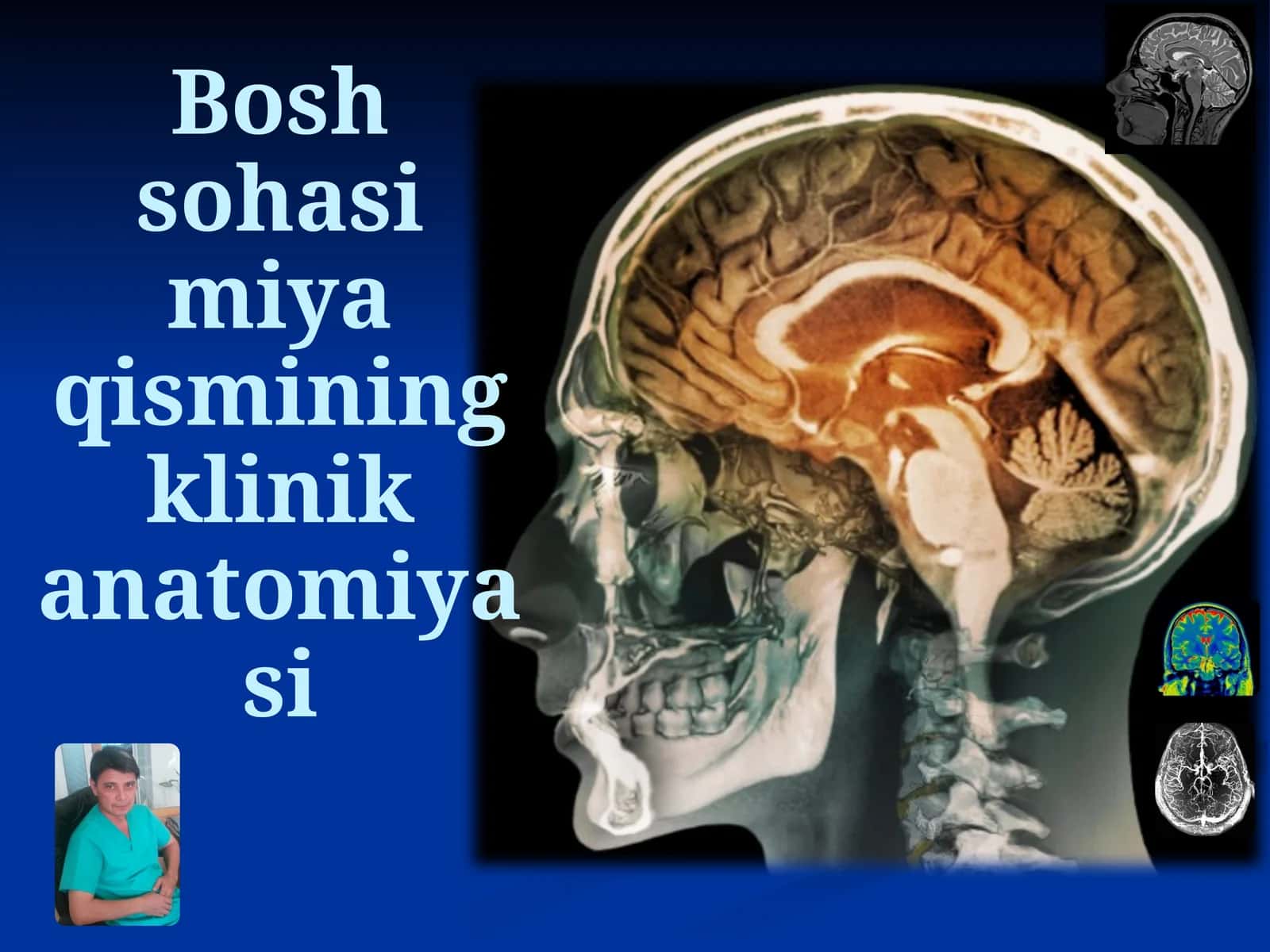 Bosh sohasi miya qismining klinik anatomiyasi 1