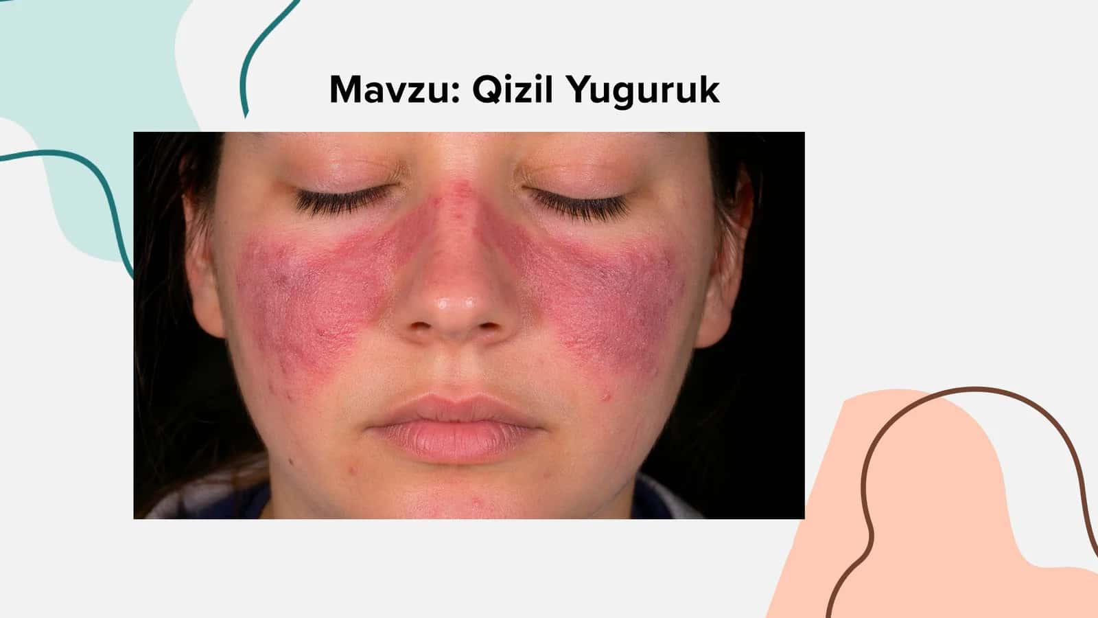Qizil Yuguruk 1