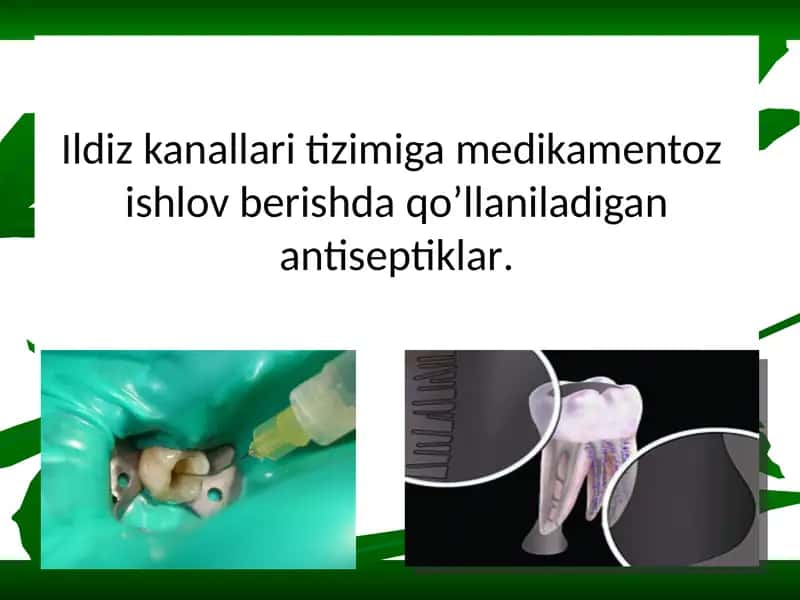 Natriy gipoxlorit (NaOCl) 1