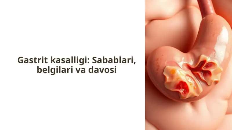 Gastrit kasalligi: Sabablari, belgilari va davosi 1