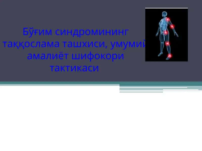 Бўғим синдроми 1