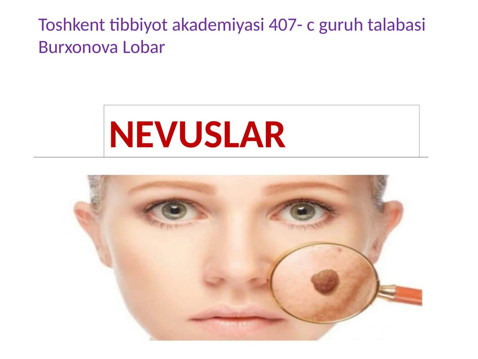 NEVUSLAR 1