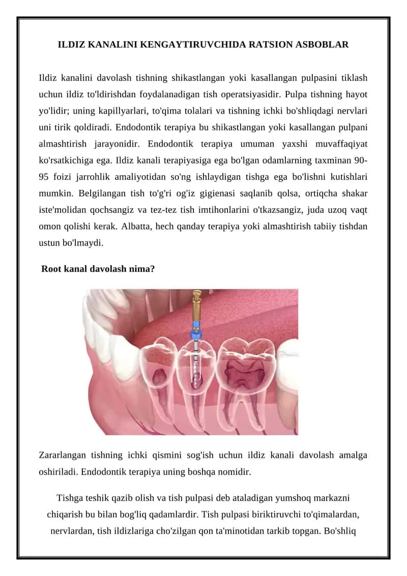 Ildiz kanali terapiyasi 1