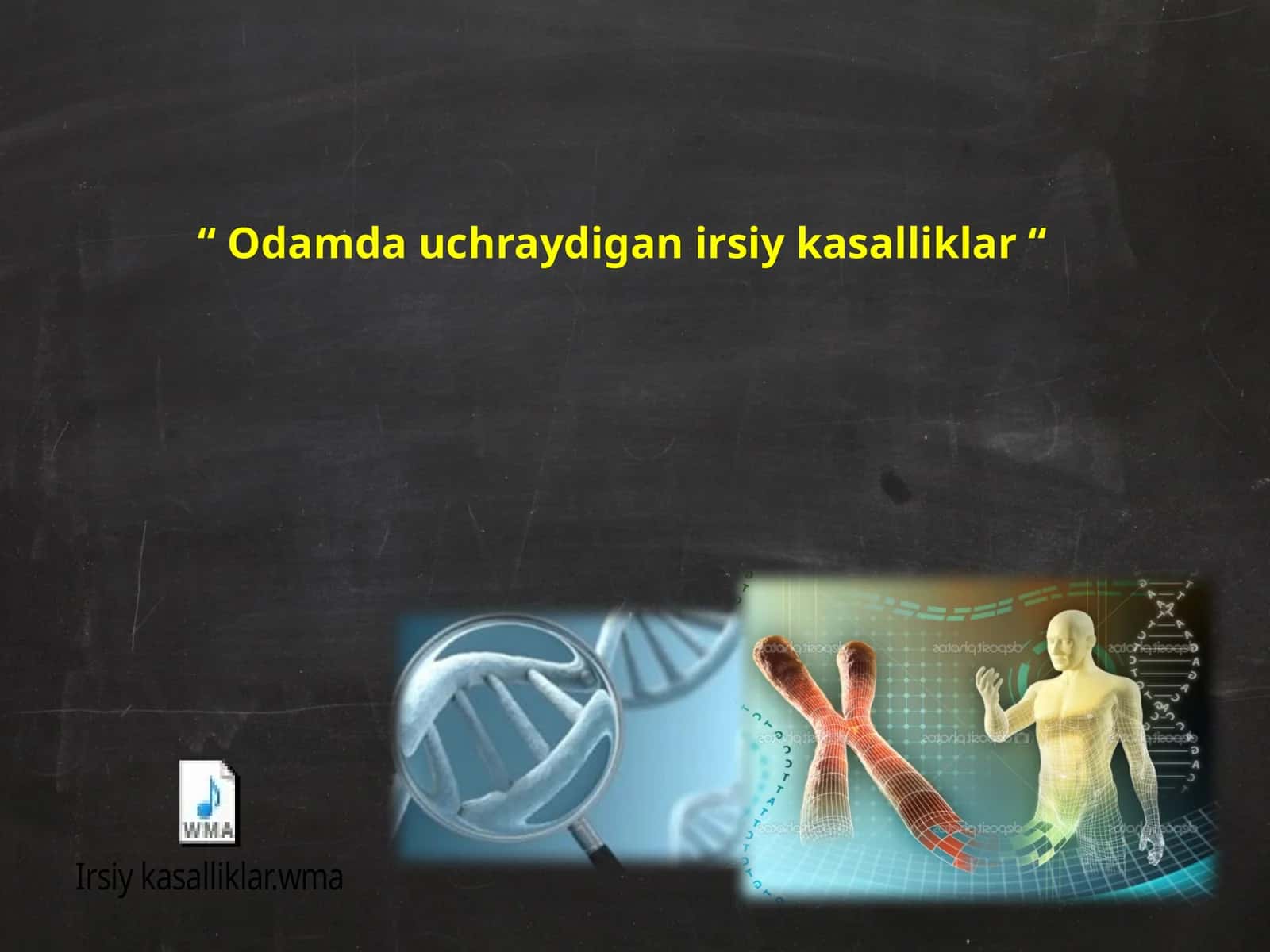 Odamda uchraydigan irsiy kasalliklar 1