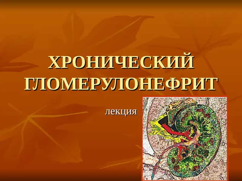 ХРОНИЧЕСКИЙ ГЛОМЕРУЛОНЕФРИТ 1
